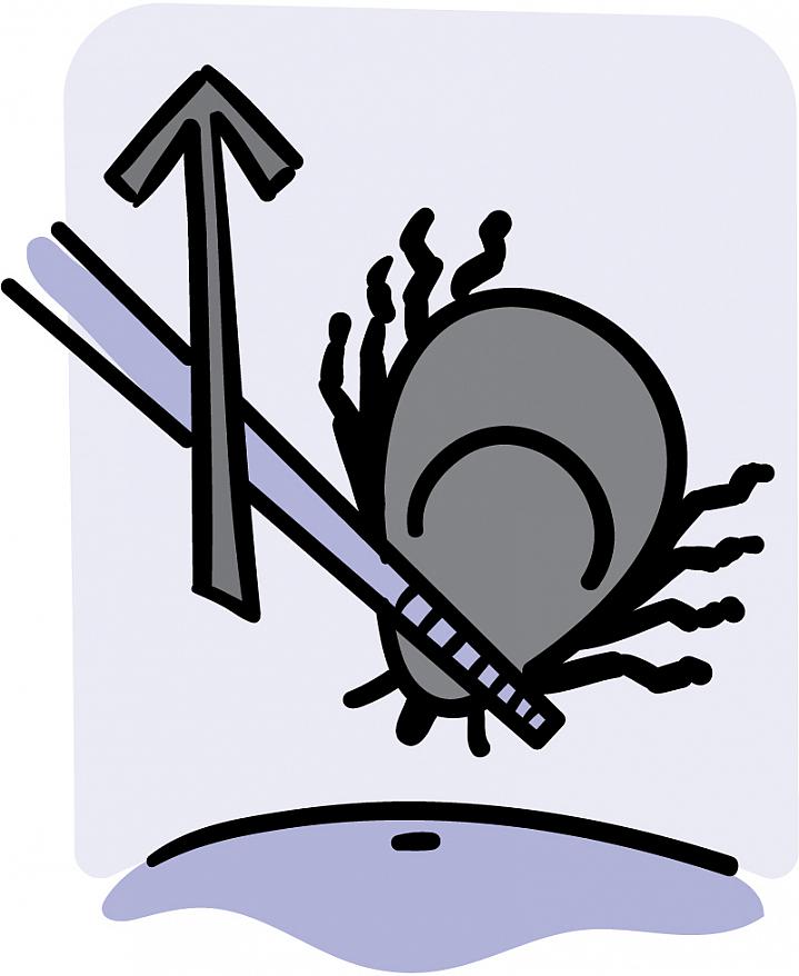 Illustration of a tick being grasped by tweezers and lifted from the skin’s surface Illustration of a tick being grasped by tweezers and lifted from the skin’s surface.