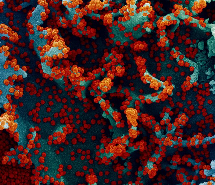 Novel Coronavirus SARS-CoV-2 Novel Coronavirus SARS-CoV-2