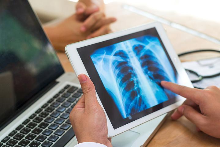 Health care provider looking at a lung X-ray in their office with a patient Health care provider looking at a lung X-ray in their office with a patient